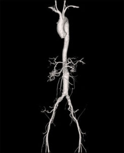 CT Scanning, CT Scan Imaging, CT Scan, Computed Tomography, CT Scan Imaging