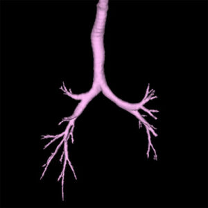 CT Scanning, CT Scan Imaging, CT Scan, Computed Tomography, CT Scan Imaging