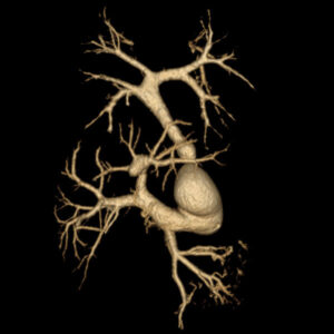 CT Scanning, CT Scan Imaging, CT Scan, Computed Tomography, CT Scan Imaging