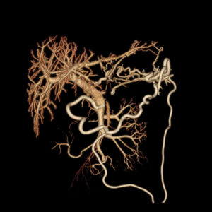 CT Scanning, CT Scan Imaging, CT Scan, Computed Tomography, CT Scan Imaging