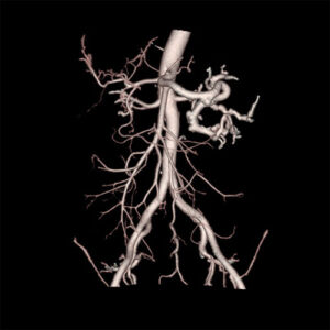 CT Scanning, CT Scan Imaging, CT Scan, Computed Tomography, CT Scan Imaging