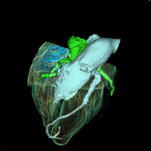 CT Scanning, CT Scan Imaging, CT Scan, Computed Tomography, CT Scan Imaging