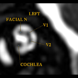 MRI Scanning, MRI Scan, MRI Imaging, MRI, Magnetic Resonance Imaging